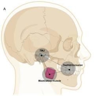 Esquema de perfil de la cabeza que relaciona la articulación temporomandibular, los dientes y el músculo masticatorio